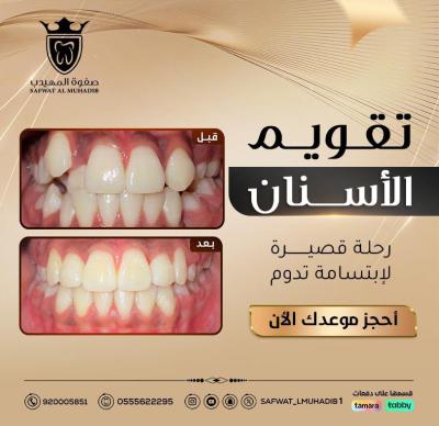 الإنجاز 1