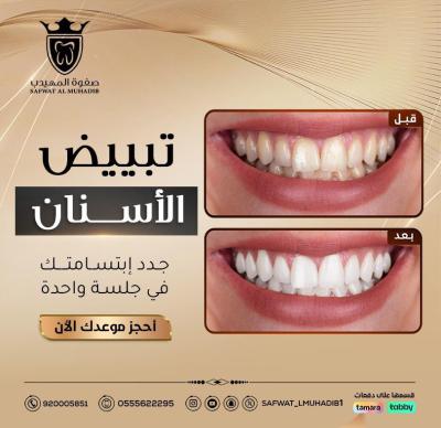 الإنجاز 2