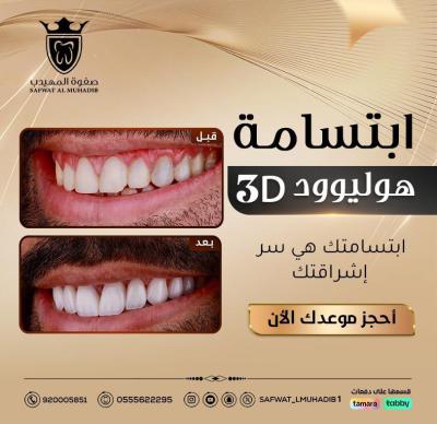 الإنجاز 4