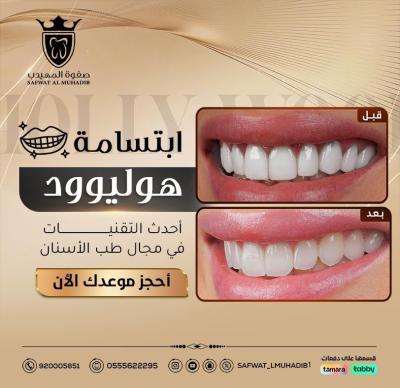 الإنجاز 3