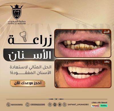 الإنجاز 5