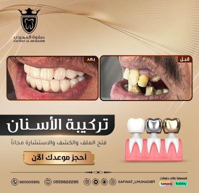 الإنجاز 6