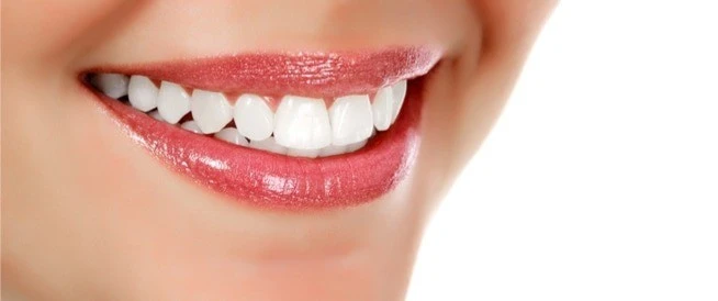 ابتسامة هوليوود في صفوة المهيدب لابتسامة مشرقة تدوم