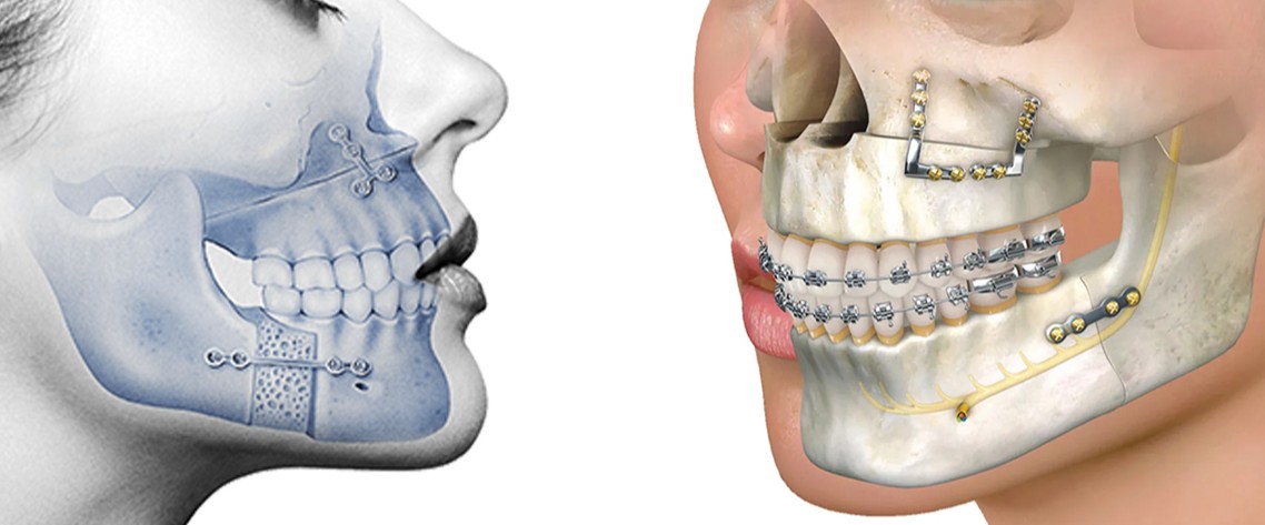 جراحة الوجه والفكين