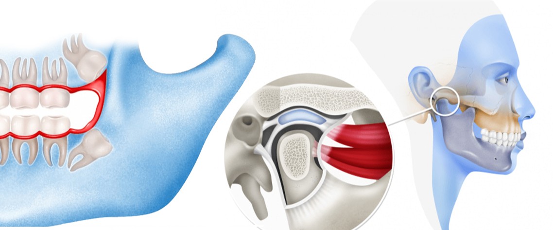 هل تعاني من كسور في الوجه أو الفك ؟