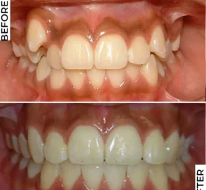 تحول مذهل: عودة الثقة والابتسامة